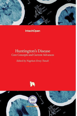 Huntington's Disease: Core Concepts and Current Advances