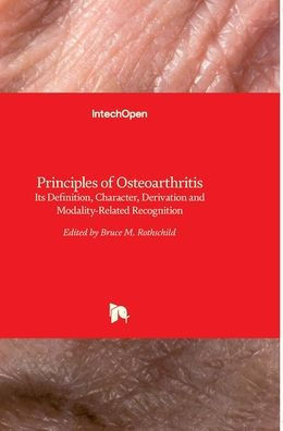 Principles of Osteoarthritis: Its Definition, Character, Derivation and Modality-Related Recognition