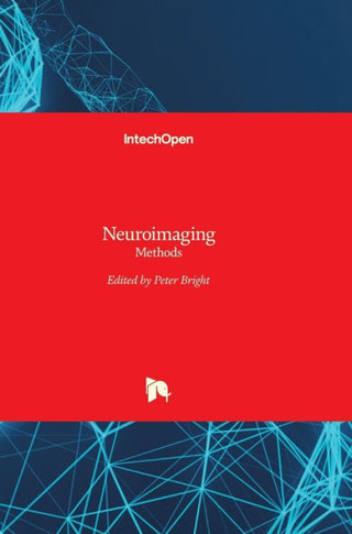 Neuroimaging: Methods