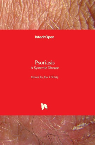 Psoriasis: A Systemic Disease