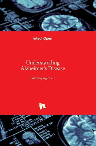 Understanding Alzheimer's Disease