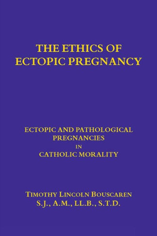 The Ethics of Ectopic pregnancy