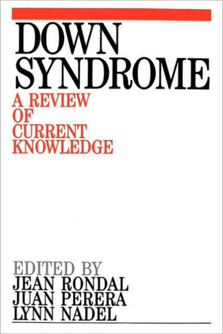 Down Syndrome: A Review of Current Knowledge