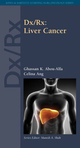 DX/Rx: Liver Cancer: Liver Cancer