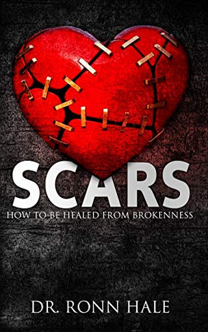 SCARS: HOW TO BE HEALED FROM BROKENNESS