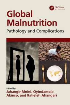Global Malnutrition : Pathology and Complications by Jahangir Moini - Hardback