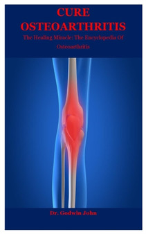 Cure Osteoarthritis : The Healing Miracle: The Encyclopedia Of Osteoarthritis by Dr Godwin John - Paperback