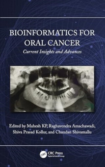Bioinformatics for Oral Cancer : Current Insights and Advances by Mahesh KP - Hardback