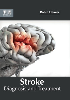 Stroke: Diagnosis and Treatment