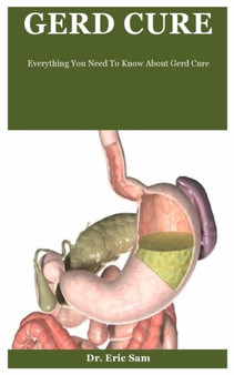 Gerd Cure : Everything You Need To Know About Gerd Cure Gerd Cure : Everything You Need To Know About Gerd Cure