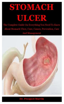 Stomach Ulcer : The Complete Guide On Everything You Need To Know About Stomach Ulcer, Cure, Causes, Prevention, Care And Management