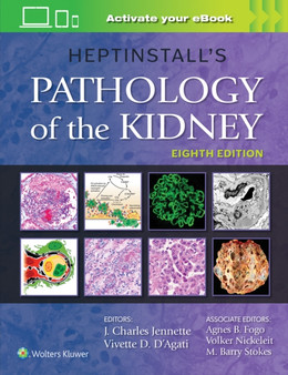 Heptinstall's Pathology of the Kidney by J.Charles Jennette - Hardback
