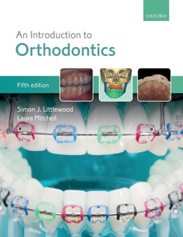 An Introduction to Orthodontics by Simon J. Littlewood - Paperback