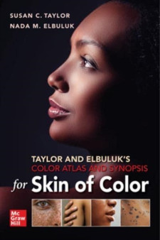 Taylor and Elbuluk's Color Atlas and Synopsis for Skin of Color by Susan Taylor - Paperback