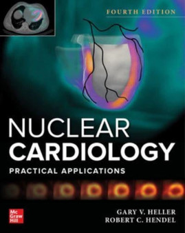 Nuclear Cardiology: Practical Applications, Fourth Edition by Gary Heller - Hardback