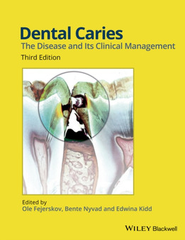 Dental Caries : The Disease and its Clinical Management by Ole Fejerskov - Hardback
