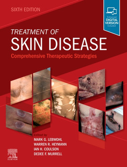Treatment of Skin Disease : Comprehensive Therapeutic Strategies by Mark Lebwohl - Hardback