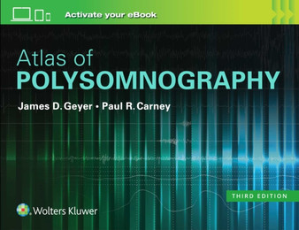 Atlas of Polysomnography by James D. Geyer - Hardback
