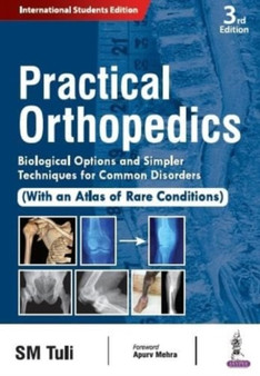 Practical Orthopedics : Biological Options and Simpler Techniques for Common Disorders by SM Tuli - Paperback