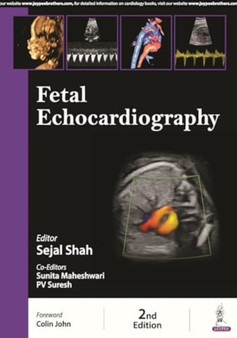 Fetal Echocardiography by Sejal Shah - Paperback