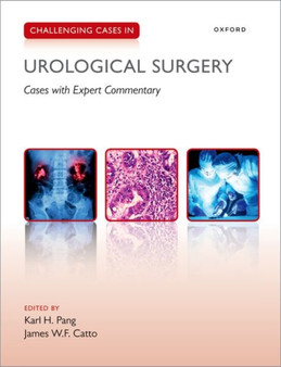 Challenging Cases in Urological Surgery by Karl Pang - Paperback