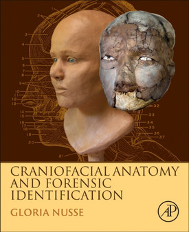 Craniofacial Anatomy and Forensic Identification by Gloria Nusse - Hardback