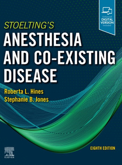 Stoelting's Anesthesia and Co-Existing Disease by Roberta L. Hines - Hardback