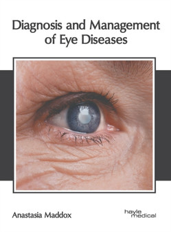 Diagnosis and Management of Eye Diseases by Anastasia Maddox - Hardback
