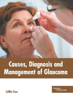 Causes, Diagnosis and Management of Glaucoma by Collin Cruz - Hardback