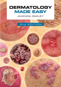 Dermatology Made Easy, second edition by Amanda Oakley - Paperback