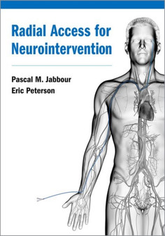 Radial Access for Neurointervention by Pascal M. Jabbour - Hardback