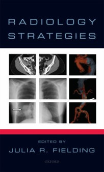 Radiology Strategies by Julia Fielding - Paperback