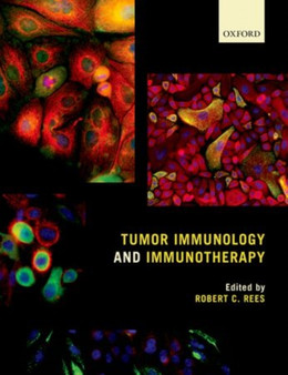 Tumor Immunology and Immunotherapy by Robert C. Rees - Hardback
