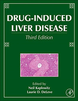 Drug-Induced Liver Disease by Neil Kaplowitz - Hardback