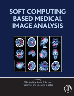 Soft Computing Based Medical Image Analysis by Nilanjan Dey - Paperback