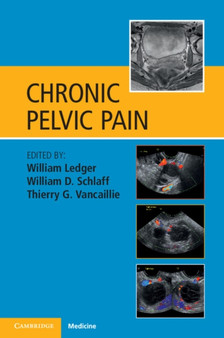 Chronic Pelvic Pain by William Ledger - Paperback