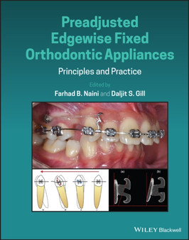 Preadjusted Edgewise Fixed Orthodontic Appliances : Principles and Practice by Farhad B. Naini - Hardback