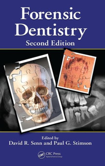 Forensic Dentistry by David R. Senn - Hardback