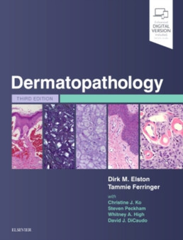 Dermatopathology by Dirk M. Elston - Hardback