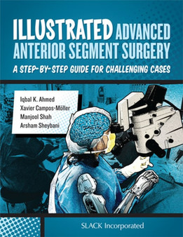 Illustrated Advanced Anterior Segment Surgery : A Step-by-Step Guide for Challenging Cases by Iqbal K Ahmed - Hardback Illustrated Advanced Anterior Segment Surgery : A Step-by-Step Guide for Challenging Cases by Iqbal K Ahmed - Hardback