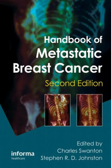 Handbook of Metastatic Breast Cancer by Charles Swanton - Hardback