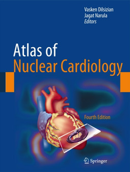 Atlas of Nuclear Cardiology by Vasken Dilsizian - Hardback