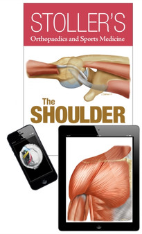 Stoller's Orthopaedics and Sports Medicine: The Shoulder Package by David W. MD FACR Stoller - Hardback