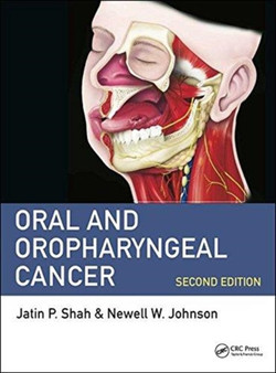 Oral and Oropharyngeal Cancer by MD FACS Jatin P. Shah - Hardback
