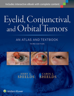 Eyelid, Conjunctival, and Orbital Tumors: An Atlas and Textbook by Dr.Jerry A. Shields - Hardback