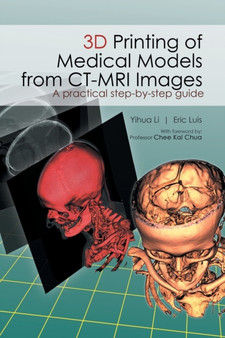 3D Printing of Medical Models from CT-MRI Images : A Practical step-by-step guide by Li Yihua - Paperback