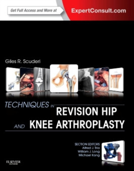 Techniques in Revision Hip and Knee Arthroplasty by Giles R MD Scuderi - Hardback