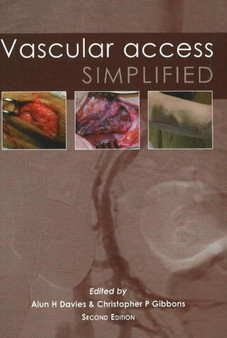 Vascular Access Simplified; second edition by Dr Alun H Davies - Paperback