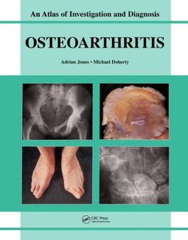 Oesteoarthritis : An Atlas of Investigation and Diagnosis by Adrian Jones - Hardback