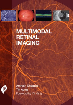 Multimodal Retinal Imaging by Amresh Chopdar - Hardback